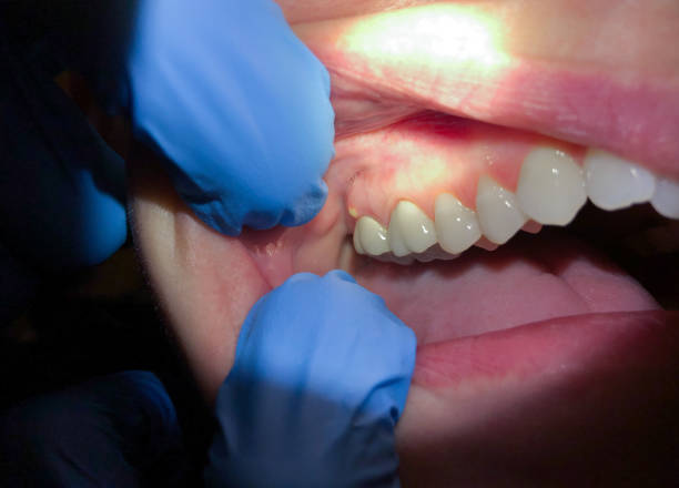 Best Emergency TMJ Treatment in Sturgeon, MO