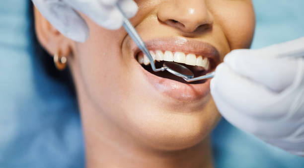 Best Emergency Dental Care for Broken or Chipped Teeth in Sturgeon, MO